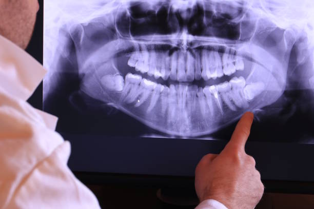 Best Weekend Emergency Dentist in Glen Carbon, IL
